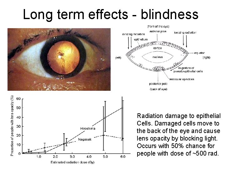 Long term effects - blindness Radiation damage to epithelial Cells. Damaged cells move to