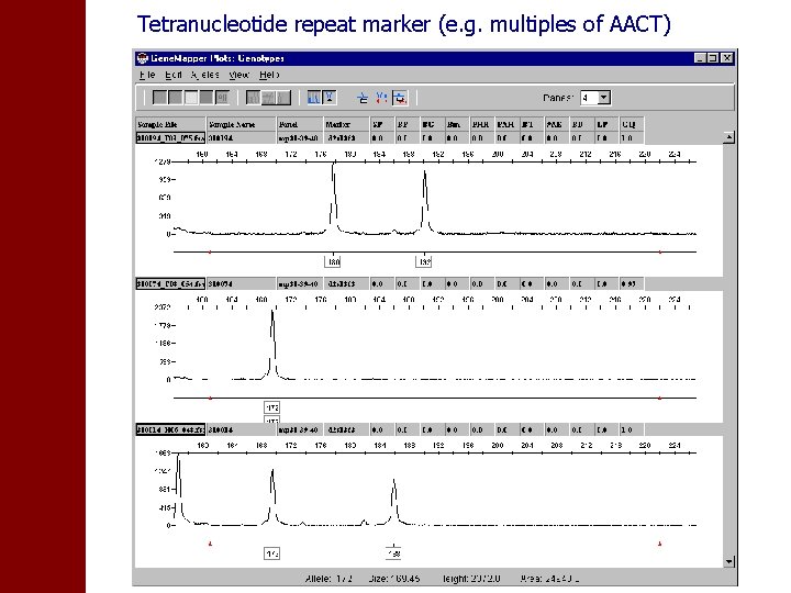 Tetranucleotide repeat marker (e. g. multiples of AACT) 