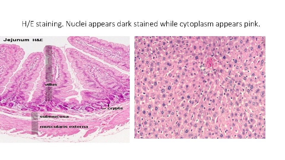 H/E staining. Nuclei appears dark stained while cytoplasm appears pink. 
