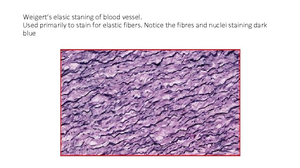 Weigert’s elasic staning of blood vessel. Used primarily to stain for elastic fibers. Notice