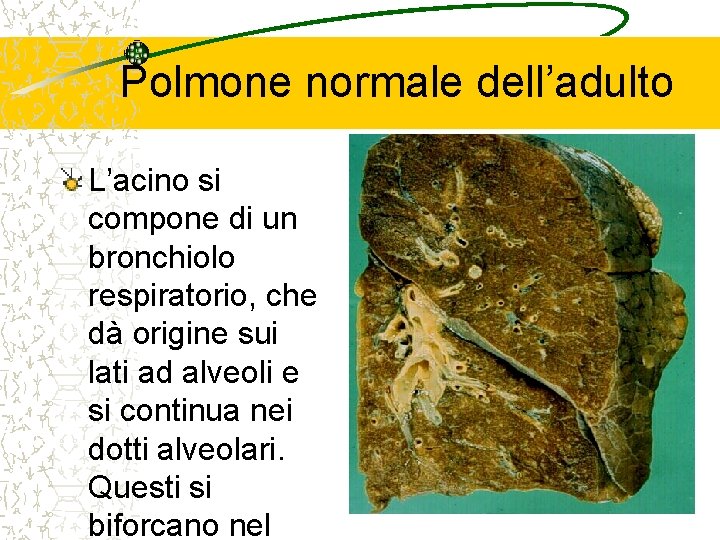 Polmone normale dell’adulto L’acino si compone di un bronchiolo respiratorio, che dà origine sui