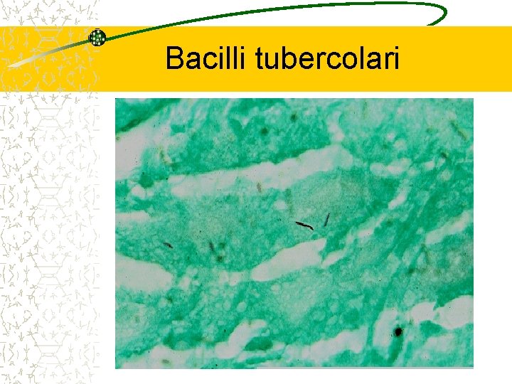 Bacilli tubercolari 