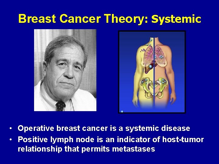 Breast Cancer Theory: Systemic • Operative breast cancer is a systemic disease • Positive