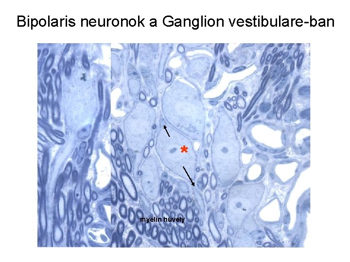 Bipolaris neuronok a Ganglion vestibulare-ban * myelin hüvely 