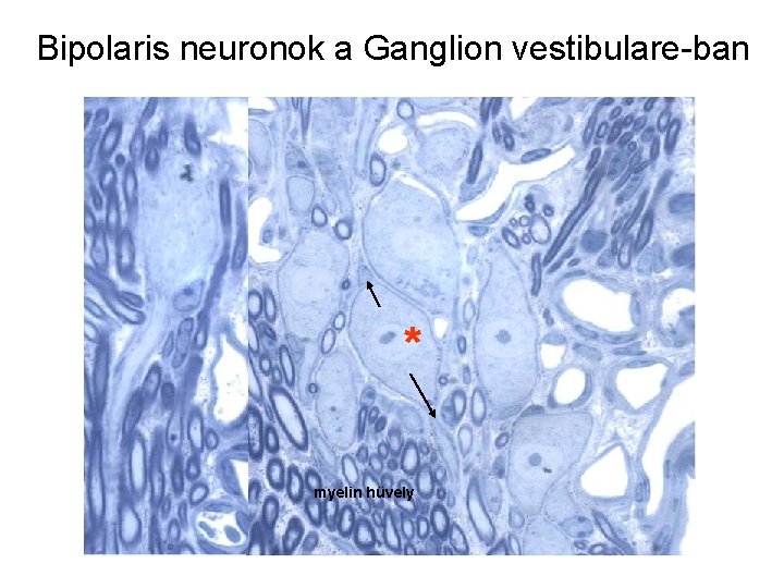 Bipolaris neuronok a Ganglion vestibulare-ban * myelin hüvely Bipolaris neuronok a Ganglion vestibulare-ban * myelin hüvely