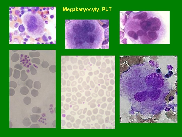 Megakaryocyty, PLT 