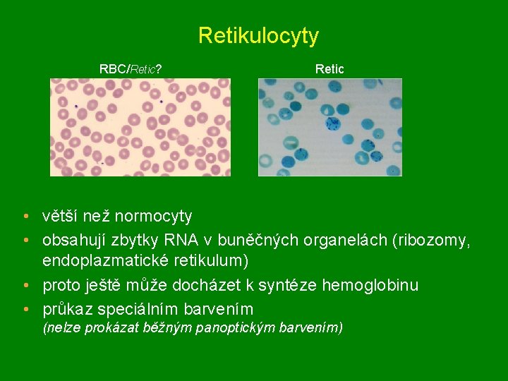 Retikulocyty RBC/Retic? Retic • větší než normocyty • obsahují zbytky RNA v buněčných organelách