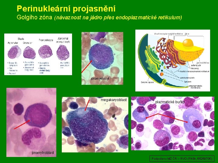 Perinukleární projasnění Golgiho zóna (návaznost na jádro přes endoplazmatické retikulum) promyelocyt megakaryoblast plazmatické buňky