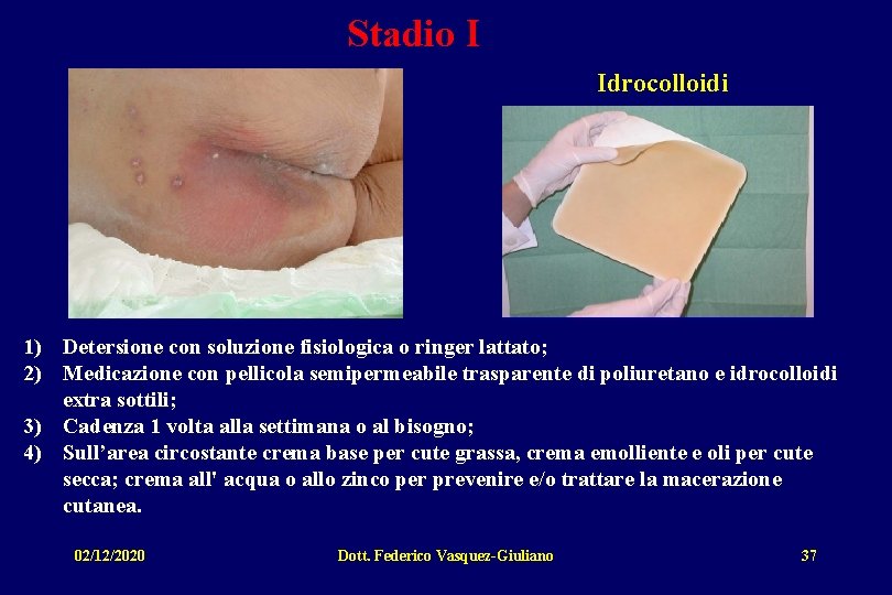 Stadio I Idrocolloidi 1) Detersione con soluzione fisiologica o ringer lattato; 2) Medicazione con