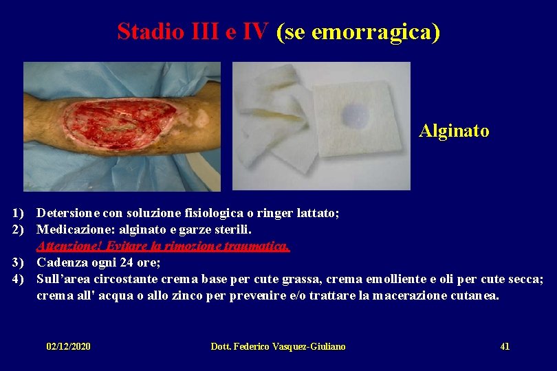 Stadio III e IV (se emorragica) Alginato 1) Detersione con soluzione fisiologica o ringer
