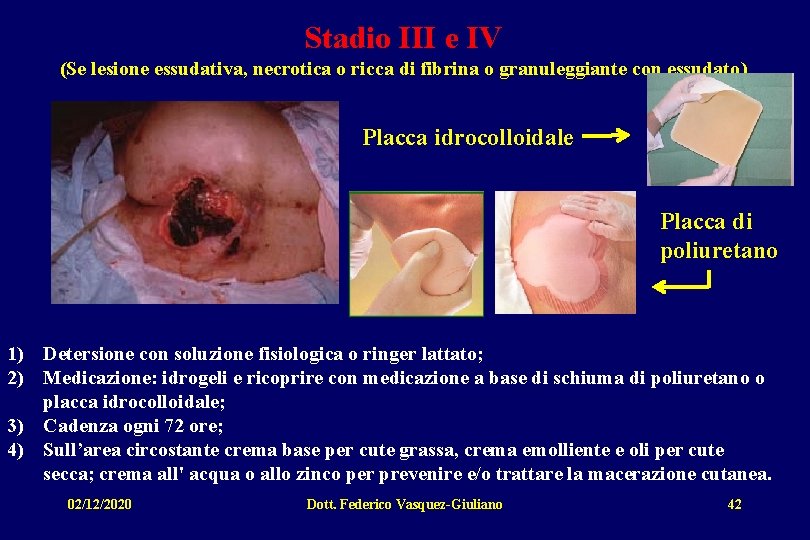 Stadio III e IV (Se lesione essudativa, necrotica o ricca di fibrina o granuleggiante