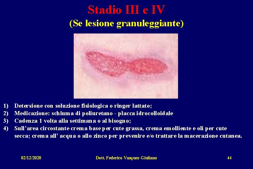 Stadio III e IV (Se lesione granuleggiante) 1) 2) 3) 4) Detersione con soluzione