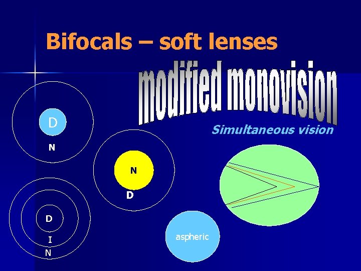 Bifocals – soft lenses D Simultaneous vision N N D D I N aspheric