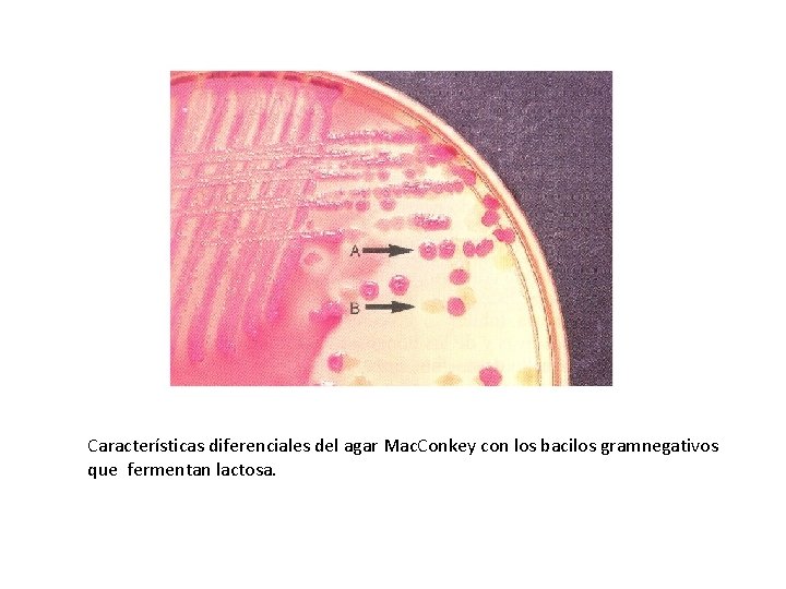 Características diferenciales del agar Mac. Conkey con los bacilos gramnegativos que fermentan lactosa. 