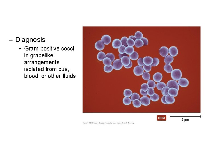 – Diagnosis • Gram-positive cocci in grapelike arrangements isolated from pus, blood, or other