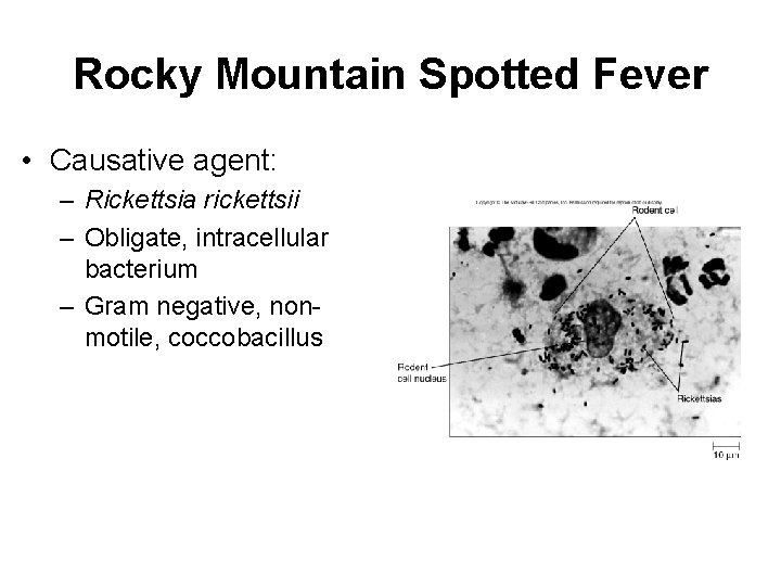 Rocky Mountain Spotted Fever • Causative agent: – Rickettsia rickettsii – Obligate, intracellular bacterium