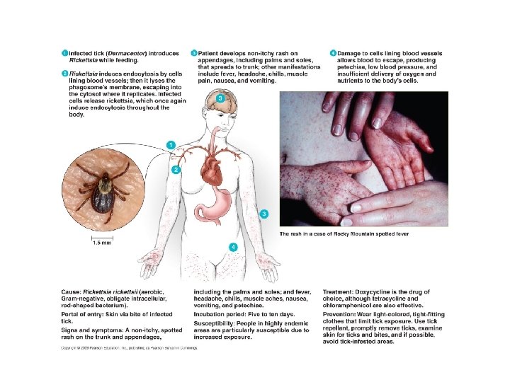 [INSERT DISEASE AT A GLANCE 19. 2] 