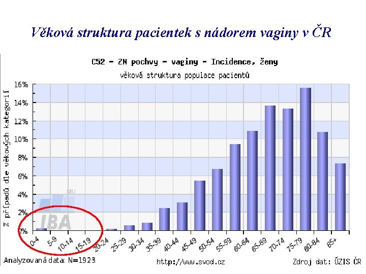 Věková struktura pacientek s nádorem vaginy v ČR 