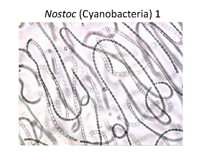 Nostoc (Cyanobacteria) 1 