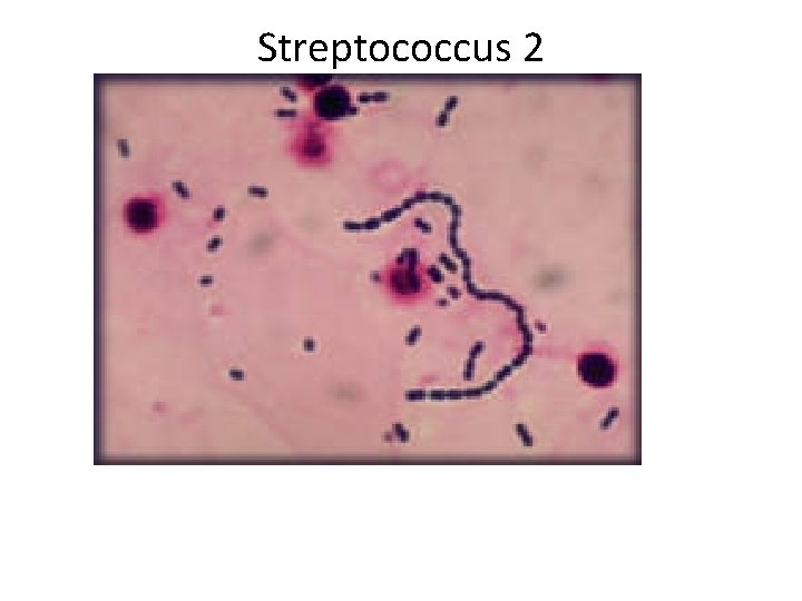 Streptococcus 2 