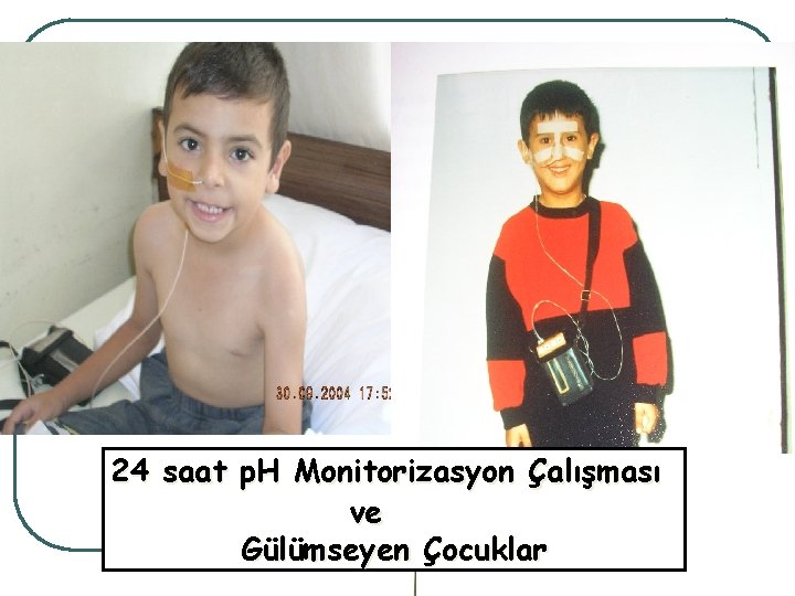 __ 24 saat p. H Monitorizasyon Çalışması ve Gülümseyen Çocuklar 