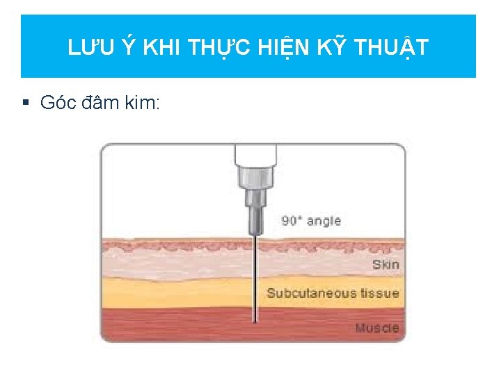 LƯU Ý KHI THỰC HIỆN KỸ THUẬT § Góc đâm kim: 