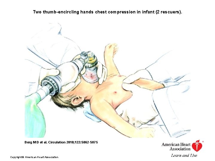 Two thumb-encircling hands chest compression in infant (2 rescuers). Berg M D et al.