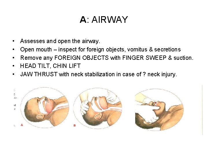 A: AIRWAY • • • Assesses and open the airway. Open mouth – inspect