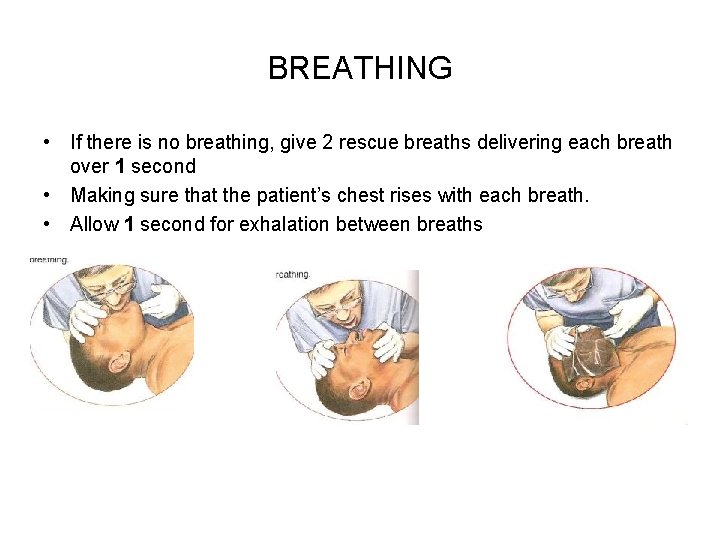 BREATHING • If there is no breathing, give 2 rescue breaths delivering each breath