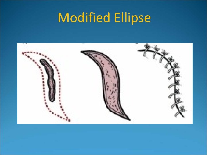 Modified Ellipse 