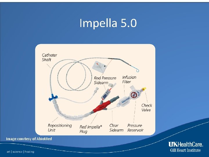 Impella 5. 0 Image courtesy of Abio. Med 