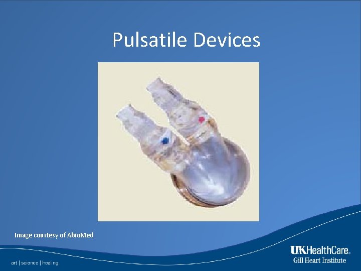 Pulsatile Devices Image courtesy of Abio. Med 