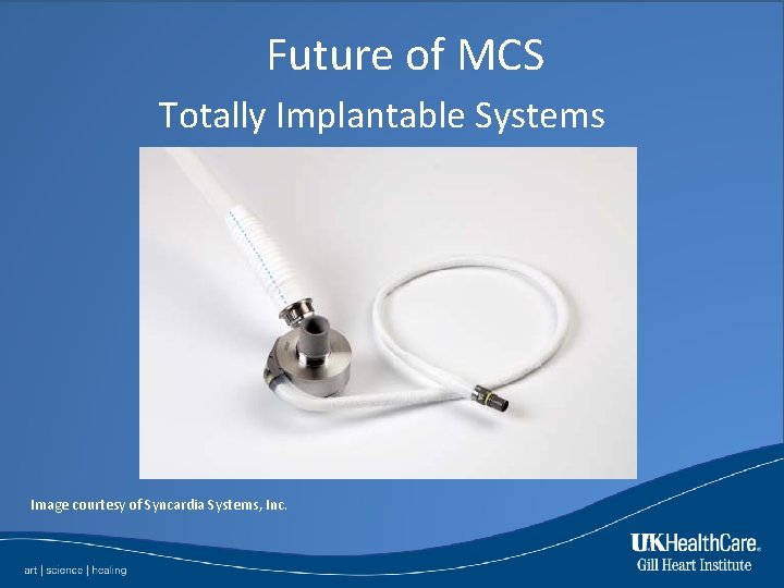 Future of MCS Totally Implantable Systems Image courtesy of Syncardia Systems, Inc. 