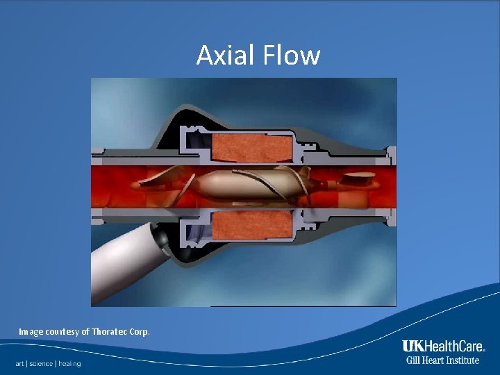 Axial Flow Image courtesy of Thoratec Corp. 