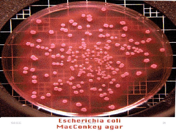 Escherichia coli, a lactose positive organism 12/2/2020 alen vukelić, dr 26 