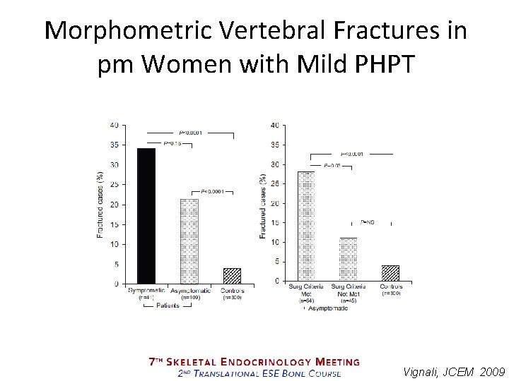 Morphometric Vertebral Fractures in pm Women with Mild PHPT Vignali, JCEM 2009 