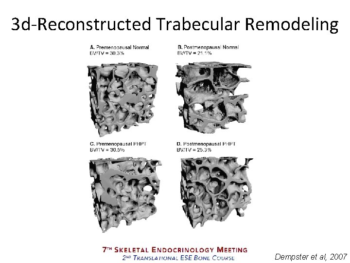 3 d-Reconstructed Trabecular Remodeling Dempster et al, 2007 