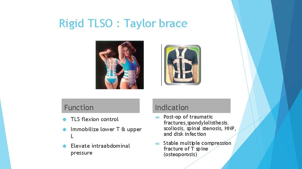 Rigid TLSO : Taylor brace Function TLS flexion control Immobilize lower T & upper
