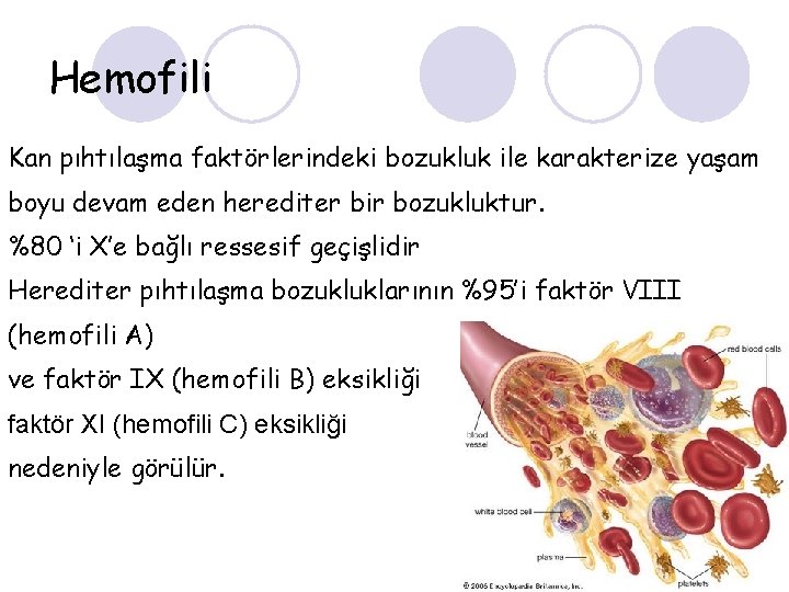 Hemofili Kan pıhtılaşma faktörlerindeki bozukluk ile karakterize yaşam boyu devam eden herediter bir bozukluktur.