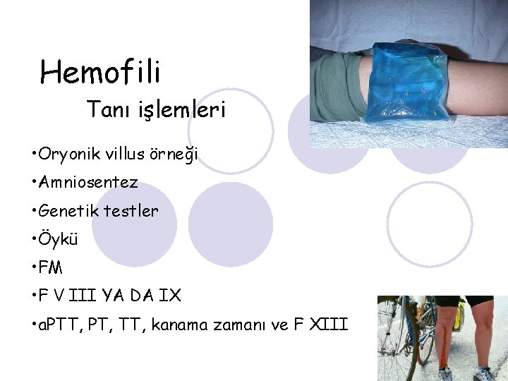 Hemofili Tanı işlemleri • Oryonik villus örneği • Amniosentez • Genetik testler • Öykü
