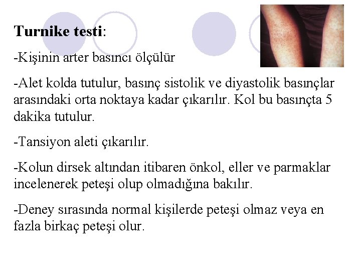 Turnike testi: -Kişinin arter basıncı ölçülür -Alet kolda tutulur, basınç sistolik ve diyastolik basınçlar