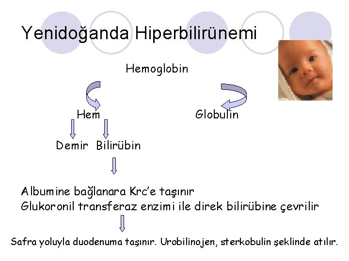 Yenidoğanda Hiperbilirünemi Hemoglobin Hem Globulin Demir Bilirübin Albumine bağlanara Krc’e taşınır Glukoronil transferaz enzimi