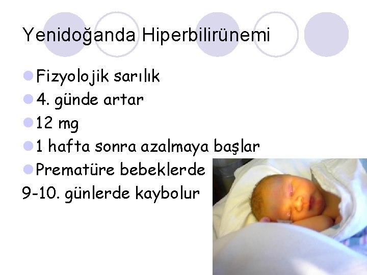 Yenidoğanda Hiperbilirünemi l Fizyolojik sarılık l 4. günde artar l 12 mg l 1