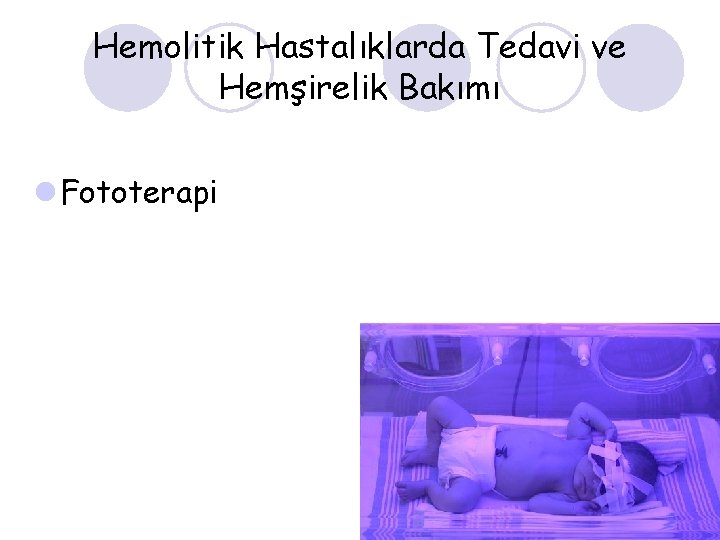 Hemolitik Hastalıklarda Tedavi ve Hemşirelik Bakımı l Fototerapi 