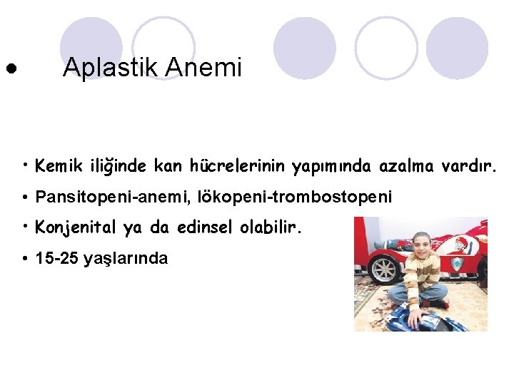 · Aplastik Anemi • Kemik iliğinde kan hücrelerinin yapımında azalma vardır. • Pansitopeni-anemi, lökopeni-trombostopeni