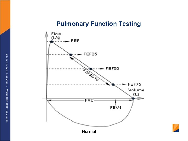 Pulmonary Function Testing Normal 