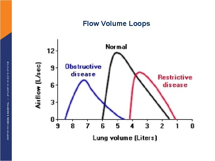 Flow Volume Loops 