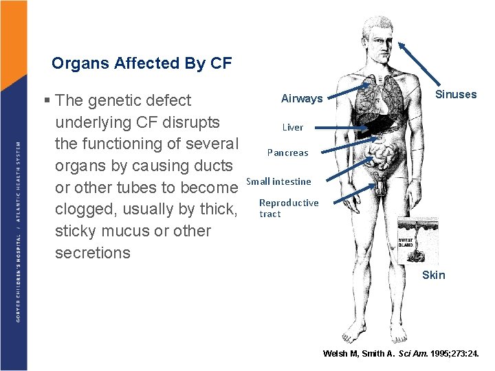 Organs Affected By CF § The genetic defect underlying CF disrupts the functioning of