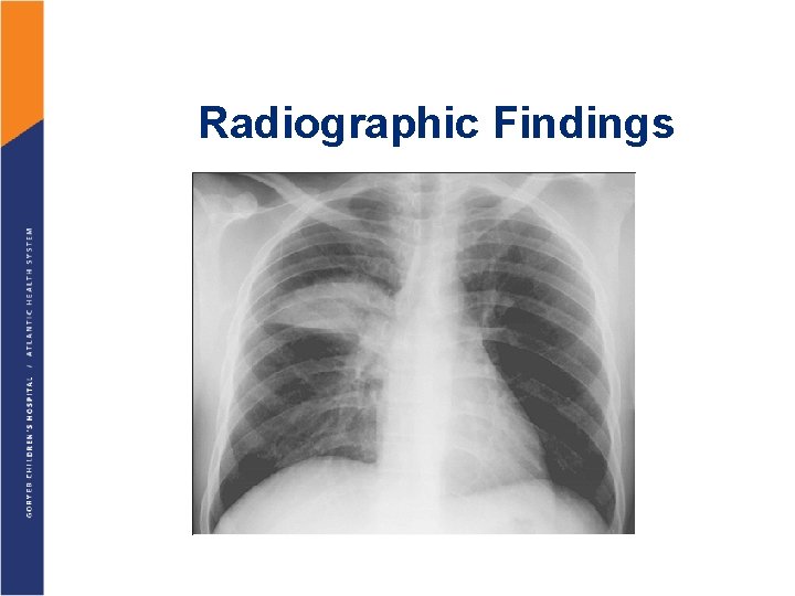 Radiographic Findings 