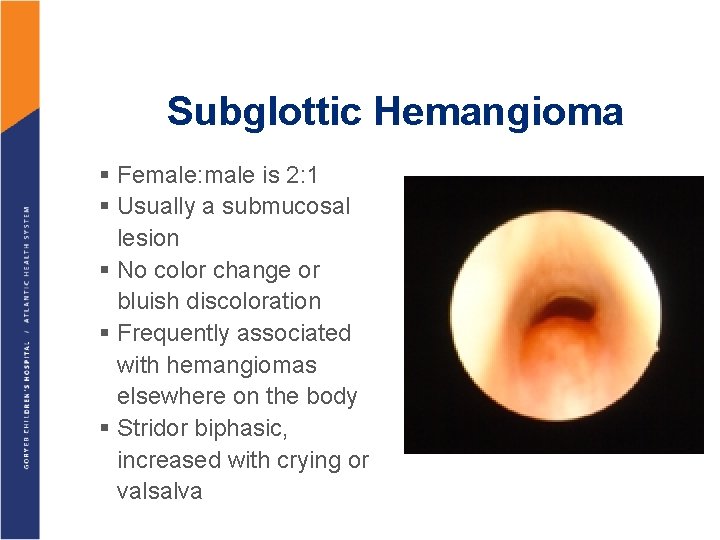 Subglottic Hemangioma § Female: male is 2: 1 § Usually a submucosal lesion §